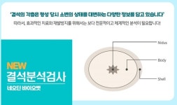 네오딘바이오벳，결석 층별로 분석하는 NEW 결석분석검사 출시