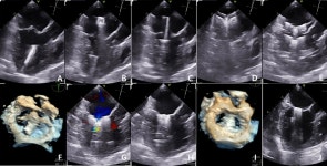 반려견 V-clamp 수술 예후, 미국수의내과학회지에 최초 게재한 고려동물메디컬센터