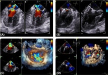 반려견 V-clamp 수술 예후, 미국수의내과학회지에 최초 게재한 고려동물메디컬센터