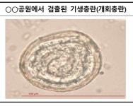 “해운대 어린이공원서 기생충란 발견…CCTV·비상벨도 없어” 부산시내 어린이공원 안전 ‘빨간불’