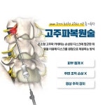 허리디스크 치료, 고주파복원술 통해 개선 도움