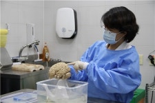 사후 뇌기증 100증례 넘어···뇌질환 조기진단 치료법 연구 
