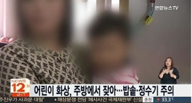 어린이 화상 주의, 성인보다 치명타…신체적 고통보다 더 큰 문제는?
