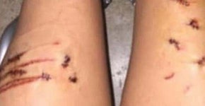 바다에서 나온 여고생의 다리는 상처로 가득했다, 소녀가 바닷속에서 있었던 일을 털어놓자 믿을 수 없다