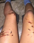 바다에서 나온 여고생의 다리는 상처로 가득했다, 소녀가 바닷속에서 있었던 일을 털어놓자 믿을 수 없다