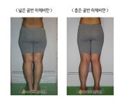 나에게 맞는 하체비만 다이어트는 무엇일까?