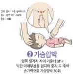[현명한 응급처치] 응급처치, 이것만 알고가자... 심폐소생술, 하임리히법