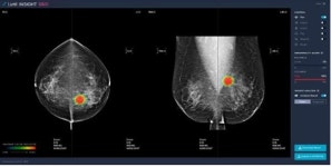 혁신의료기기 신속하게 의료현장으로 (진입기간 390일→80일)