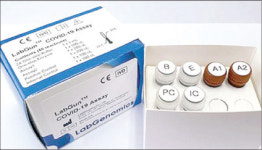 한국산 진단키트 배포 시작