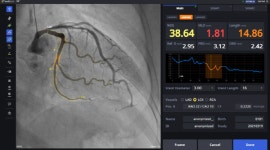 메디픽셀, 심혈관 AI 기술 미국 특허 획득