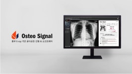 프로메디우스, 흉부 X-ray 기반 골다공증 선별 AI 평가 유예 신의료기술 선정