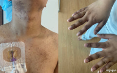 [삼성 갤럭시 조립하던 21살 청년] 백혈병 걸리자 회사는 무급휴직 끝 해고