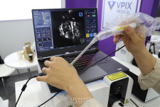 수술 중 잔존 암세포 실시간 확인 가능한 ‘초소형 현미경’