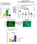 안전성, 유효성 극대화 된 파킨슨병 세포치료제 개발 착수