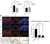 연세대 세브란스병원 검버섯 등 피부 색소 침착 치료 가능성 제시