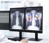 딥노이드, 딥팍스프로 식약처 의료기기제조인증 인증 획득