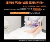 강남 에르네의원, 문제성발톱 전문치료센터 개설