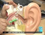 닥터/여름철 귀 건강 이렇게