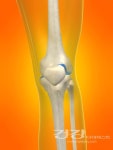 [의학정보] 욱신욱신~ 연골 손상 최신 치료법 뭐가 있을까?
