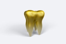 [치아건강] 금니 대신 지르코니아! 왜?