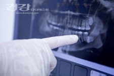 방학맞이 치아교정 이벤트 多, 전문성을 우선으로 선택하는 것이 중요