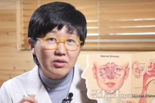 [계절건강] 똑똑한 현대인들의 축농증 탈출방법