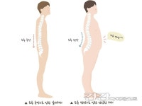 [박진영 한의사의 척추이야기] 약간 배 나온 사람이 오래 사는 이유