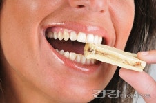 [김문섭의 치아시크릿] 임플란트 전에 알았더라면…