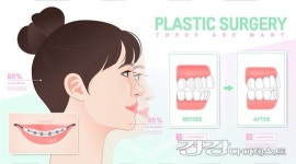 치아교정 치료 시 꼼꼼한 치과 선정 노하우