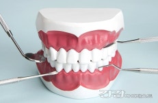 [김문섭의 치아시크릿] 잇몸 약보다 스케일링… 왜?