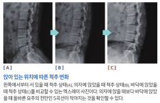 [관절 살리는 진짜 운동법] 소중한 내 허리 안 아프게 관리하기