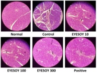 위랩, 서목태 이용 안구건조 개선 기능성 원료 개발 성공