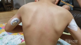 [소아당뇨맘의 눈물] 자녀 돌보려 직구한 의료기기가 불법이라니