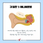 여름철 귀 건강 솔루션 알아봅시다!