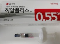 식약처, LG화학 히알2000주·히알플러스주 회수조치...안정성시험 부적합