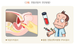 소변 보기 힘든 남성들 전립선암 검진 받아야