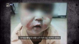 추적60분 발암물질 내뿜는 아스콘 공장, 아이들의 건강이 위험하다