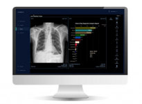 제이엘케이, AI 폐질환 솔루션 日진출···해외 판로 확장 속도
