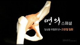 [EBS 명의] 고관절 골절 후 1년내 사망률 25%…김희중·권순용 교수의 질환 종류·치료법