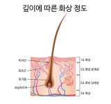 선생님 심재성 2도 화상으로 적어주세요!