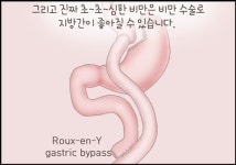 지방간이라면 꼭 지켜야 할 것들