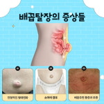탈장은 모두 서혜부? 배꼽과 주변통증의 배꼽(제대)탈장도 있다