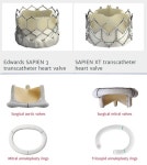 세계를 선도하는 의료기기 만든 비결 캘리포니아 스타트업·의사들과 공동 개발