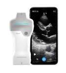 GE헬스케어, 휴대용 무선 듀얼 초음파 ‘브이스캔 에어 SL’ 출시