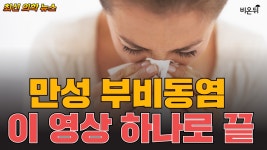 지긋지긋한 콧물, 해결책은 아토피 치료제? (서울특별시보라매병원 이비인후과 김대우)