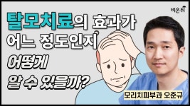 탈모치료의 효과가 어느 정도인지 어떻게 알 수 있을까? / 모리치피부과 오준규