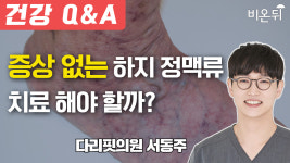 증상 없는 하지 정맥류 치료 해야 할까?/ 다리핏의원 서동주