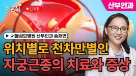 위치별로 천차만별인 자궁근종의 치료와 증상 / 서울성모병원 산부인과 송재연