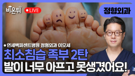 최소침습 족부 2탄, 발이 너무 아프고 못생겼어요! / 연세백퍼센트병원  정형외과 이모세