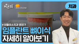 [제주] 임플란트 뼈이식의 모든것 (정상기의 구강 방송국)_서울미소치과 정상기